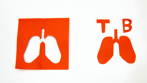 Red paper cutouts of lungs next to the letters TB.